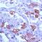 Keratin 8 antibody, PA5-32469, Invitrogen Antibodies, Immunohistochemistry frozen image 