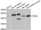 Fibromodulin antibody, A05030, Boster Biological Technology, Western Blot image 