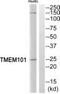 Transmembrane Protein 101 antibody, PA5-39595, Invitrogen Antibodies, Western Blot image 