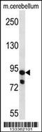 Ubiquitin Specific Peptidase 45 antibody, 57-035, ProSci, Western Blot image 