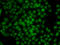 ATM Interactor antibody, LS-C346399, Lifespan Biosciences, Immunofluorescence image 