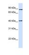 Thioredoxin Related Transmembrane Protein 4 antibody, orb325492, Biorbyt, Western Blot image 