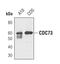 Cell Division Cycle 73 antibody, PA5-17158, Invitrogen Antibodies, Western Blot image 