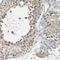 SEC23 Homolog B, Coat Complex II Component antibody, NBP1-85732, Novus Biologicals, Immunohistochemistry paraffin image 