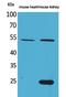 Secretogranin III antibody, PA5-51075, Invitrogen Antibodies, Western Blot image 