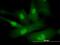 Sperm Autoantigenic Protein 17 antibody, H00053340-B01P, Novus Biologicals, Immunofluorescence image 