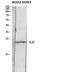 Interleukin-22 antibody, STJ97675, St John