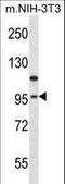 Eukaryotic Elongation Factor 2 Kinase antibody, LS-C164369, Lifespan Biosciences, Western Blot image 