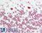 Nucleolin antibody, LS-B11335, Lifespan Biosciences, Immunohistochemistry paraffin image 