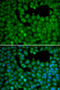 Neuroepithelial Cell Transforming 1 antibody, STJ24743, St John