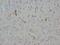 Neurofilament Heavy antibody, LS-C171218, Lifespan Biosciences, Immunohistochemistry paraffin image 