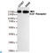 EGFR antibody, LS-C812958, Lifespan Biosciences, Western Blot image 
