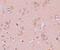 Pleckstrin Homology Domain Containing M3 antibody, 5487, ProSci, Immunohistochemistry paraffin image 