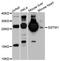 Glutathione S-Transferase Mu 1 antibody, A8819, ABclonal Technology, Western Blot image 