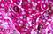 Neuromedin U Receptor 1 antibody, NLS396, Novus Biologicals, Immunohistochemistry paraffin image 