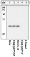 Casein Kinase 2 Beta antibody, GTX12861, GeneTex, Western Blot image 