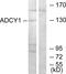 Adenylate Cyclase 1 antibody, LS-B10007, Lifespan Biosciences, Western Blot image 