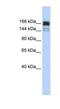 5'-3' Exoribonuclease 1 antibody, NBP1-57281, Novus Biologicals, Western Blot image 