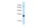 THO Complex 3 antibody, GTX47239, GeneTex, Western Blot image 
