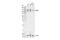 RNA Binding Motif Protein 10 antibody, 47729S, Cell Signaling Technology, Western Blot image 