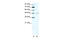 Cholinergic Receptor Nicotinic Delta Subunit antibody, 31-099, ProSci, Western Blot image 