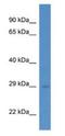 RAB5C, Member RAS Oncogene Family antibody, NBP1-74182, Novus Biologicals, Western Blot image 