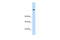 Mediator Complex Subunit 16 antibody, 27-350, ProSci, Western Blot image 