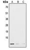 Granzyme B antibody, LS-C353826, Lifespan Biosciences, Western Blot image 