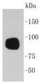 Ribosomal Protein S6 Kinase A1 antibody, NBP2-67570, Novus Biologicals, Western Blot image 