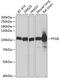 Glycogen Phosphorylase B antibody, 15-054, ProSci, Western Blot image 