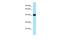 ADP-Ribosylhydrolase Like 2 antibody, A09929, Boster Biological Technology, Western Blot image 