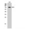 Solute Carrier Family 28 Member 2 antibody, LS-C382787, Lifespan Biosciences, Western Blot image 