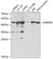 Partitioning defective 6 homolog alpha antibody, GTX54628, GeneTex, Western Blot image 