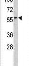 Receptor Like Tyrosine Kinase antibody, PA5-14735, Invitrogen Antibodies, Western Blot image 