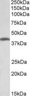 Threonine Synthase Like 2 antibody, PA5-37954, Invitrogen Antibodies, Western Blot image 