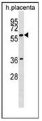 GRB2 Associated Binding Protein 3 antibody, AP51753PU-N, Origene, Western Blot image 