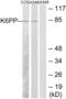 PFKP antibody, abx013565, Abbexa, Western Blot image 