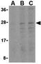 BH3 Interacting Domain Death Agonist antibody, GTX31690, GeneTex, Western Blot image 