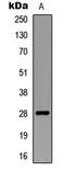 E3 ubiquitin-protein ligase RNF138 antibody, LS-C358285, Lifespan Biosciences, Western Blot image 