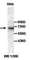 MUS81 Structure-Specific Endonuclease Subunit antibody, orb77426, Biorbyt, Western Blot image 