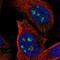 Zinc Finger Protein 71 antibody, HPA018124, Atlas Antibodies, Immunofluorescence image 