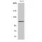 Signal Transducer And Activator Of Transcription 2 antibody, LS-C386209, Lifespan Biosciences, Western Blot image 