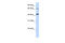 Glutaminyl-Peptide Cyclotransferase Like antibody, 26-209, ProSci, Western Blot image 