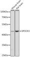 SPARC (Osteonectin), Cwcv And Kazal Like Domains Proteoglycan 3 antibody, 14-660, ProSci, Western Blot image 