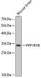 Protein Phosphatase 1 Regulatory Inhibitor Subunit 1B antibody, 13-223, ProSci, Western Blot image 