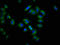 CLPTM1 Like antibody, LS-C672824, Lifespan Biosciences, Immunofluorescence image 