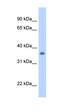 Sarcoglycan Gamma antibody, orb330374, Biorbyt, Western Blot image 