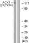 ACK1 antibody, PA5-37782, Invitrogen Antibodies, Western Blot image 