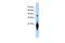 Chromosome 17 Open Reading Frame 49 antibody, GTX45566, GeneTex, Western Blot image 