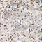BAF Chromatin Remodeling Complex Subunit BCL11A antibody, A5445, ABclonal Technology, Immunohistochemistry paraffin image 